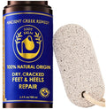Dry Cracked Heels Repair with Pumice Stone | Organic Foot Cream by AncientGreekRemedybyBlissofGreece