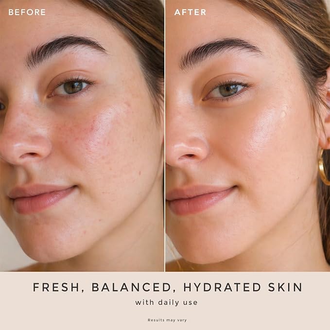 Rose Water Spray for Face - Image 2