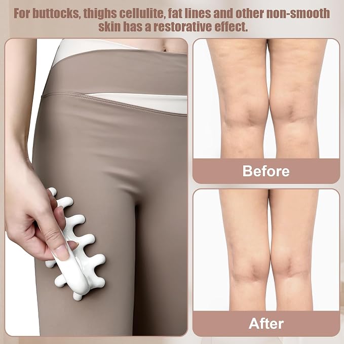 Fascia Massage Tool Trigger Point Massage Tools Anti Blaster - Image 5
