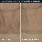 RoC Derm Correxion Retinol Firming Serum Stick - Image 4
