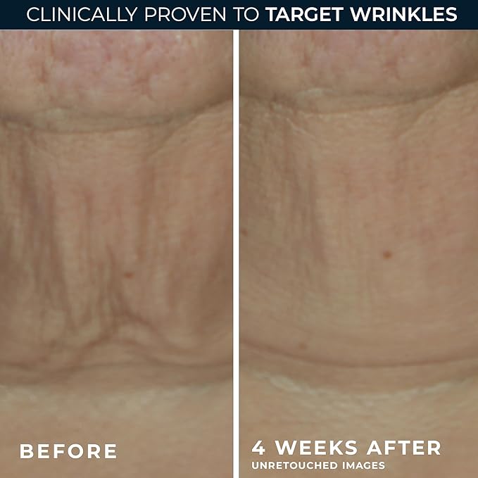 RoC Derm Correxion Retinol Firming Serum Stick - Image 4