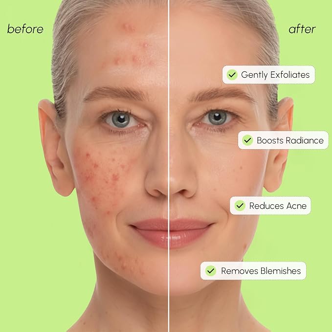 MAREE Exfoliating Toner with Salicylic Acid – AHA BHA Face Exfoliant & Pore - Image 4