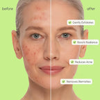 MAREE Exfoliating Toner with Salicylic Acid – AHA BHA Face Exfoliant & Pore - Image 4