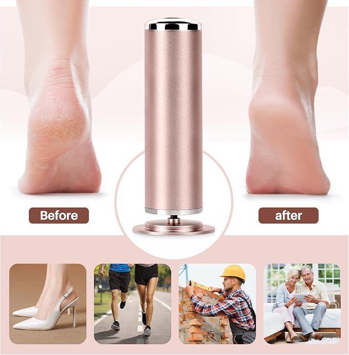 Electric Foot File Remover Callus: Profesional Pedicure Tool - Image 5