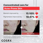 COSRX 15% Niacinamide Face Serum, 0.67 fl oz, Pore Minimizer Serum - Image 4