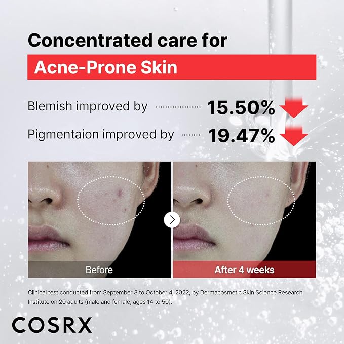 COSRX 15% Niacinamide Face Serum, 0.67 fl oz, Pore Minimizer Serum - Image 4