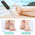 Professional Pedicure Foot File, Coarse/Fine Double Side and Reusable Stainless - Image 6