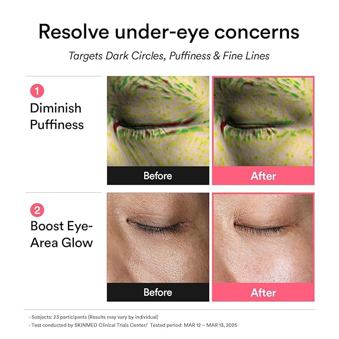 Abib PDRN Retinal Eye Patches for Rejuvenating & Puffy Eyes - Image 4