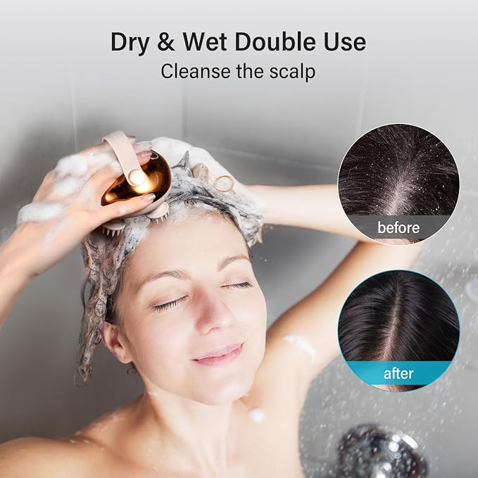 arboleaf Electric Scalp Massager Head Massager Scalp Stress Relax, 5 in 1 - Image 4