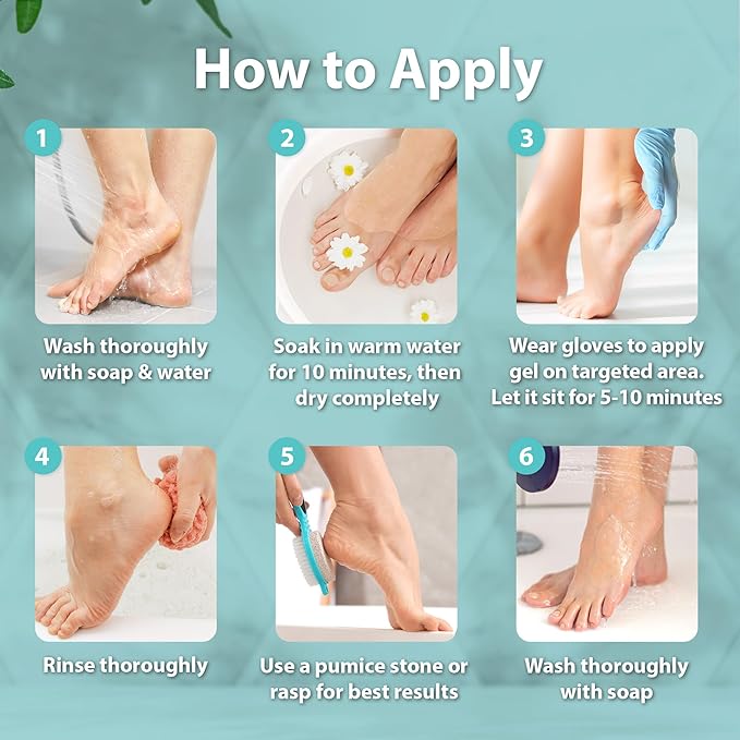 Ebanel Professional Callus Remover - Image 6