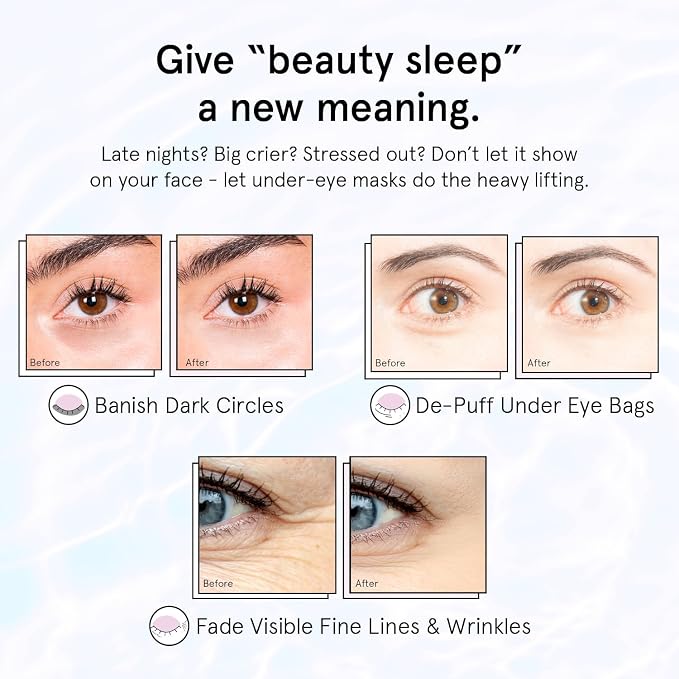 grace & stella Retinol Under Eye Patches - Image 4