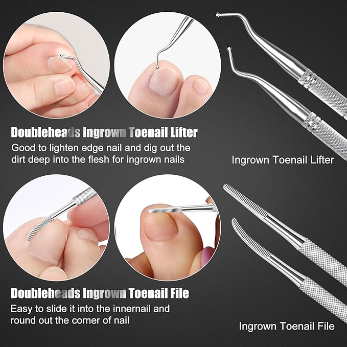 7-Piece Ingrown Toenail Treatment Set, Professional Stainless Steel Ingrown - Image 6