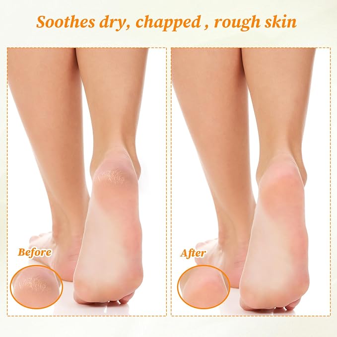 6 Pairs Moisturizing Socks Gloves Set, Spa Foot Moisturizer Socks & Cotton - Image 5
