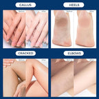 OUKEYA Urea Cream 42% plus Salicylic Acid 2% Net 12.35 Oz Foot & Hand Cream - Image 9