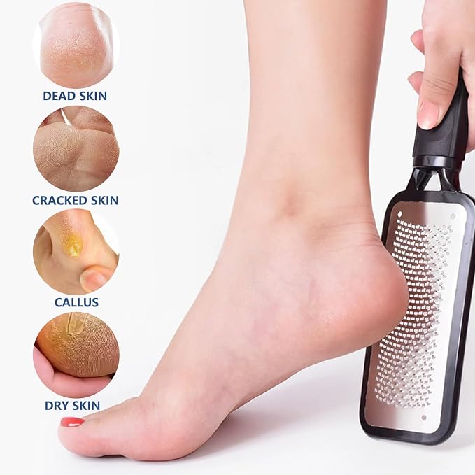 2 Pack Colossal Foot Files Kit Callus Remover Stainless Steel Dual Sided Foot - Image 4
