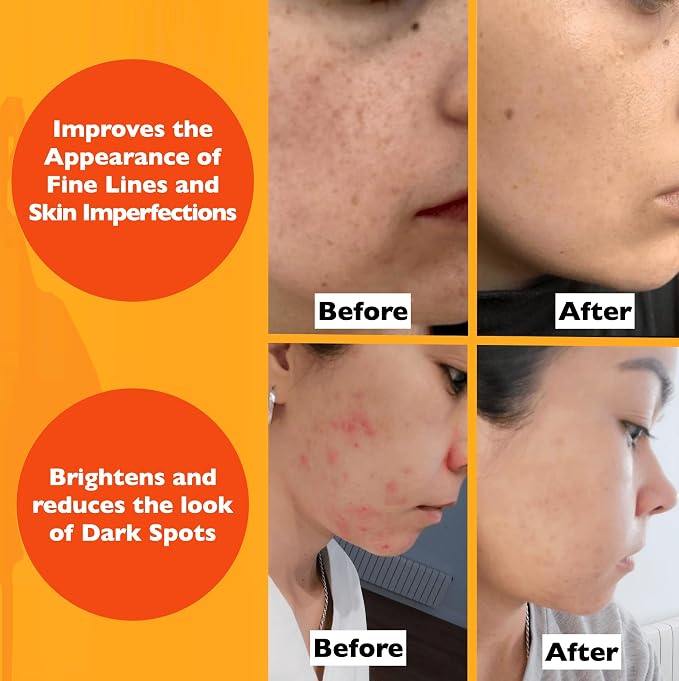 Vitamin C Serum For Face – Anti Aging Face Serum - Image 5