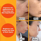Vitamin C Serum For Face – Anti Aging Face Serum - Image 5