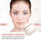 Leeshine Ice Roller Ball for Face and Eyes - Image 4