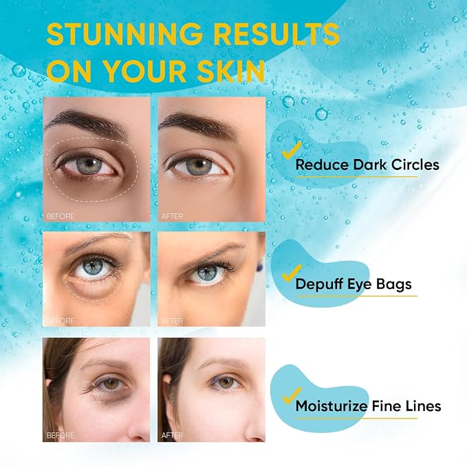 Under Eye Patches – 30 Pairs Hydrating Gel Masks - Image 7