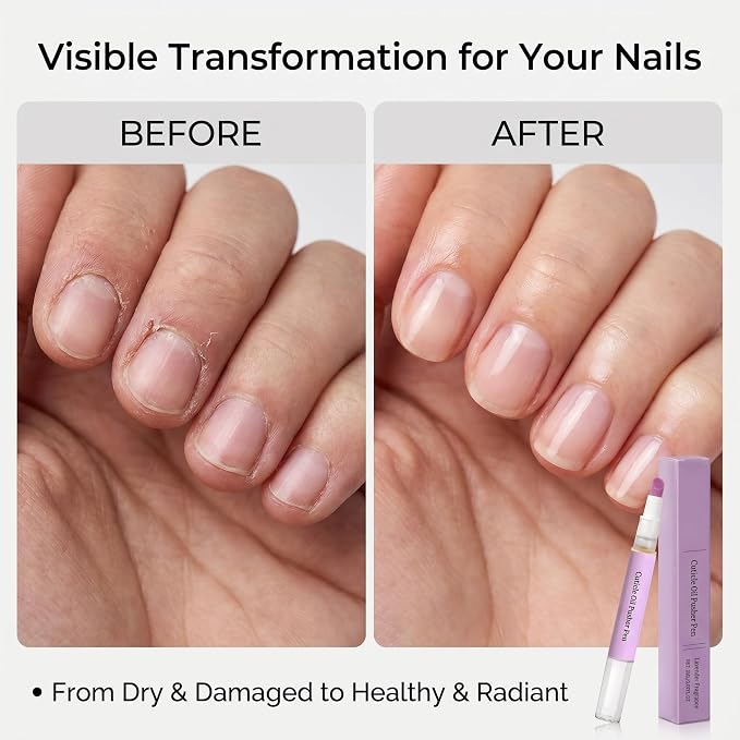 Ceramic Cuticle Pusher & Nail Oil Pen, 2-in-1 Nail Care Tool, Gentle Hangnail - Image 4