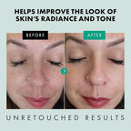 Eclat Skincare Clarifying Niacinamide Serum - Image 4