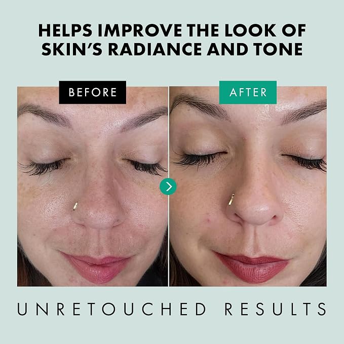 Eclat Skincare Clarifying Niacinamide Serum - Image 4