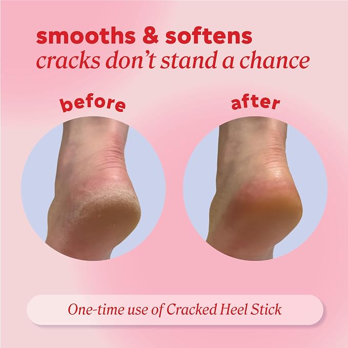Onyx Professional Cracked Heel Repair Balm Stick - Image 4