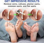 Ulensy Corn Remover Liquid for Toes Feet: 20ml Salicylic Acid for Foot Corns - Image 6