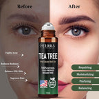 Fiora Naturals Tea Tree Oil Roll On - Image 4