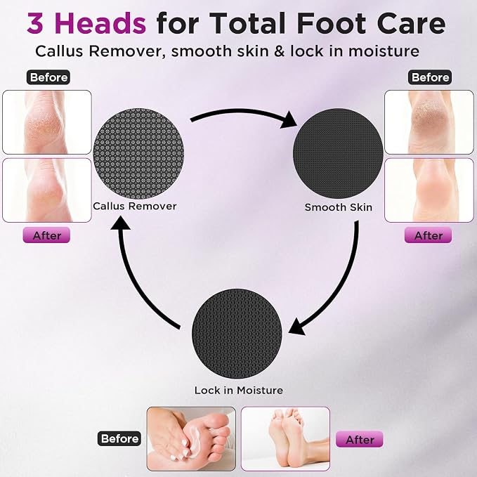 Electric Foot Callus Remover, Apply Oil, Foot SPA, Foot File, Reusable - Image 3