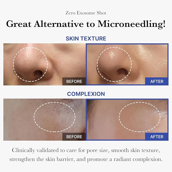 medicube Exosome Shot Zero 2, 000 PPM Spicule Facial Serum | Liquid Skin - Image 3