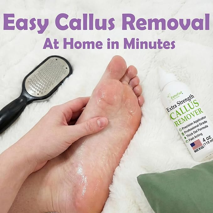 Dr. Entre's Callus Remover Gel & Foot File: Extra Strength Callus Remover - Image 5