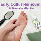Dr. Entre's Callus Remover Gel & Foot File: Extra Strength Callus Remover - Image 5