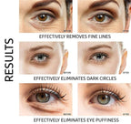 Under Eye Patches - Image 2