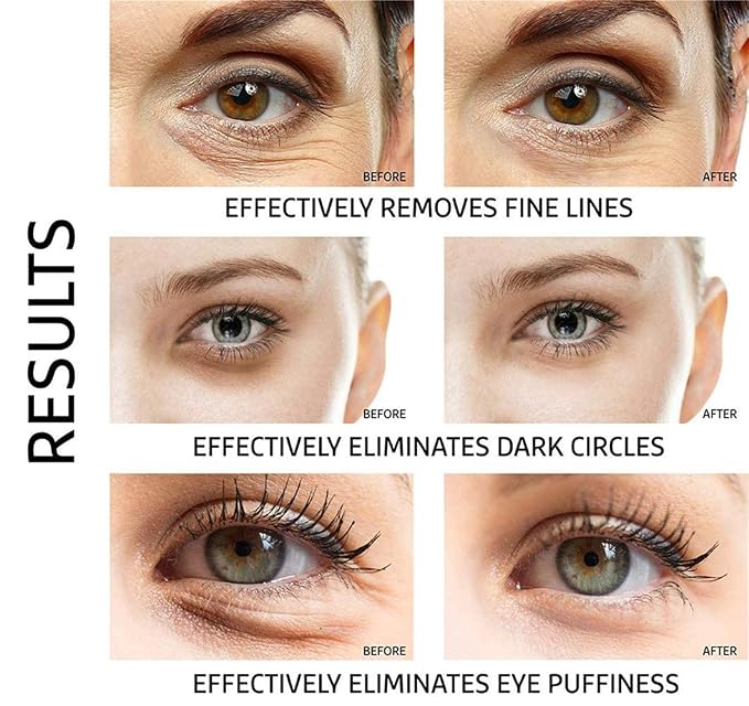 Under Eye Patches - Image 2
