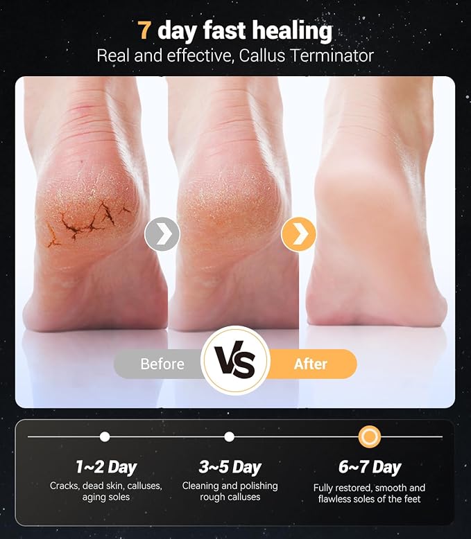 Electric Foot Callus Remover, Rechargeable Electric Callus Remover - Image 5
