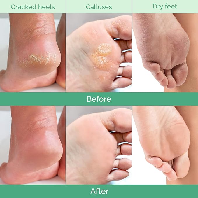 PLANTIFIQUE Foot Peeling Mask - Image 4