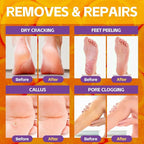 Pedicure Foot Soak, Foot Spa Soak, Pedicure Kit, Bubble Foot Bath - Image 3