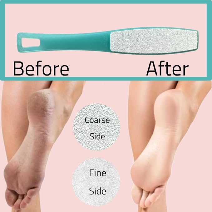1 ALAZCO Double Sided Foot File Pumice Ergonomic Handle Scrubber Immediate - Image 3