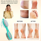 Foot File Callus Remover 5-in-1, Scrubber Brush, Stainless Steel Foot Rasp and - Image 3