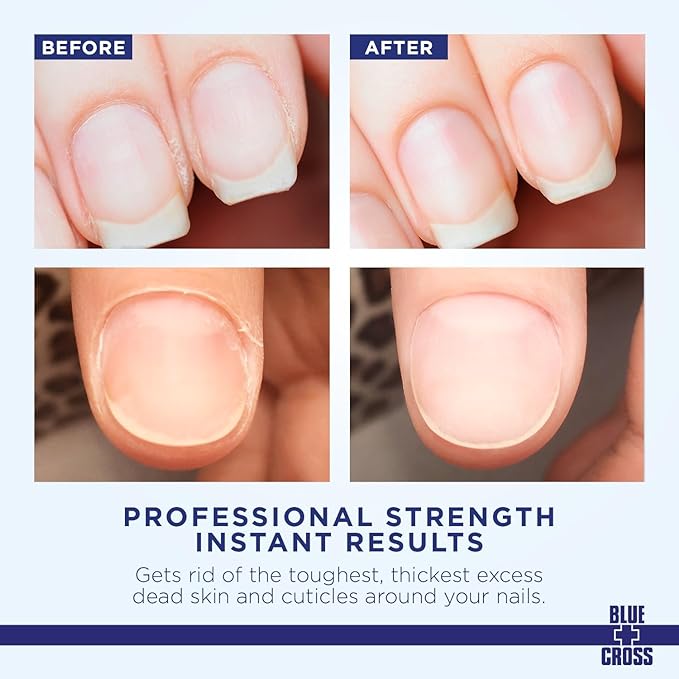 Cuticle Remover & Softener Liquid - Image 2