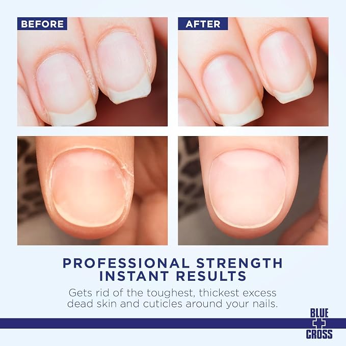Cuticle Remover & Softener Liquid - Image 2