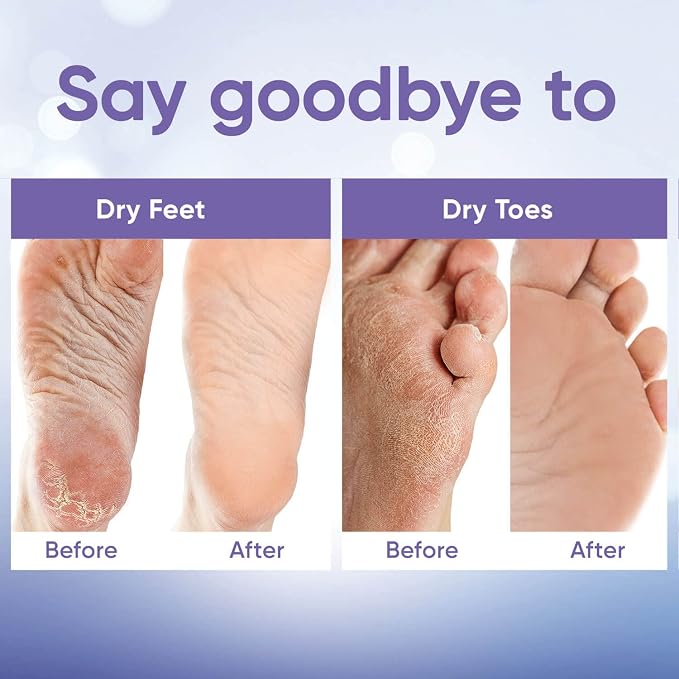 CÉLOR Foot Peeling Mask for Dry Cracked Feet | Foot Mask to Exfoliate Rough - Image 4