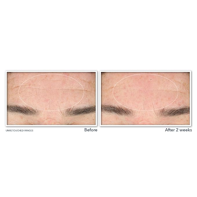 RoC Retinol Correxion Deep Wrinkle Serum Facial Cleanser - Image 3