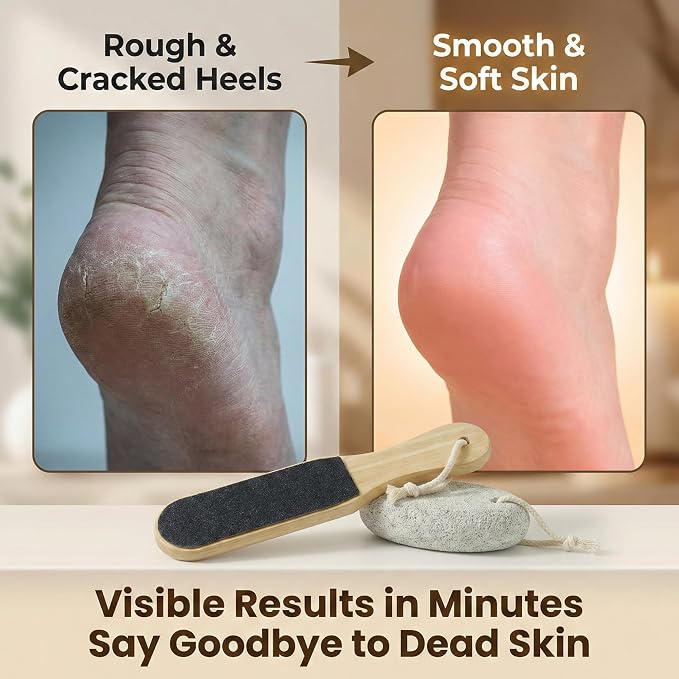 2-Piece Foot File and Pumice Stone Set, Wooden Callus Remover - Image 4
