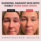 Eclat Skincare Renewing Retinol Serum - Image 4