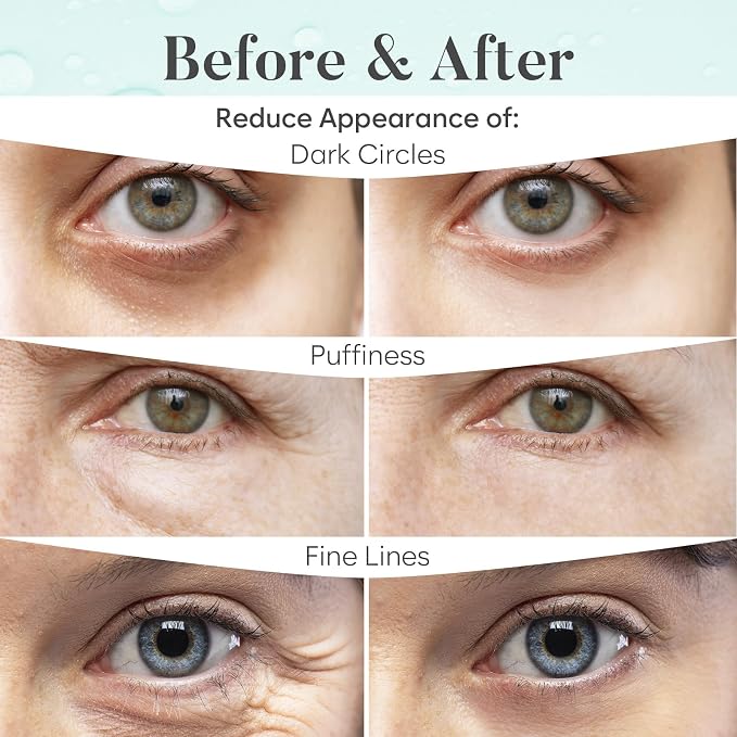 BLOOMORA Aloe Vera Under Eye Patches, - Image 4