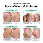 Tea Tree Oil Foot Soak with Epsom Salt - Image 3