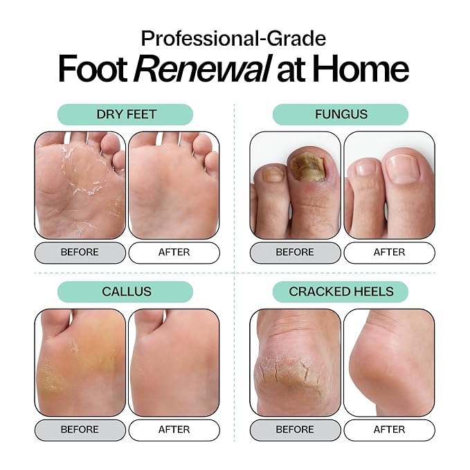 Tea Tree Oil Foot Soak with Epsom Salt - Image 3