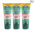 Dermatonics 10% Urea Callus Removing Cream – Removes Hard Skin, Moisturizes and by Dermatonics